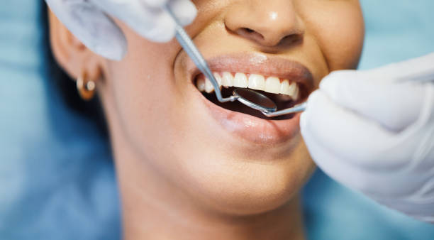 Best Emergency Wisdom Tooth Extraction in Liberty, NC