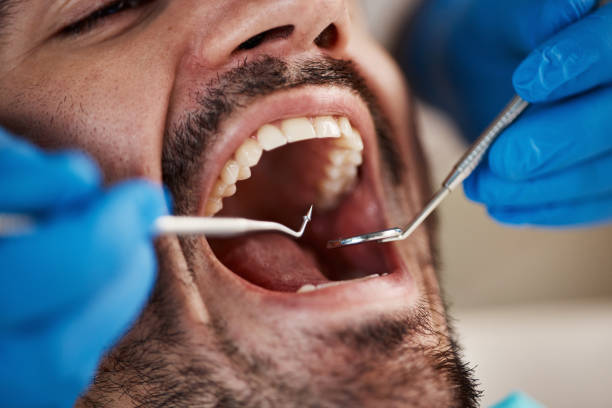 Best Broken or Chipped Tooth Repair in Liberty, NC